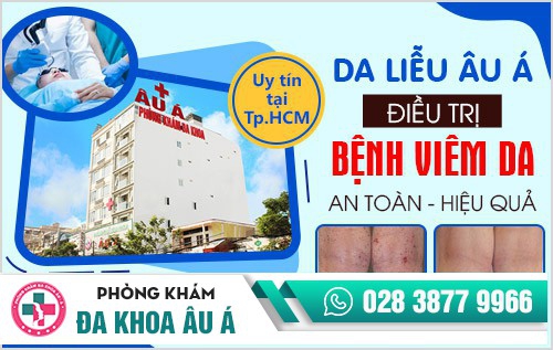 Địa chỉ chữa bệnh viêm da uy tín tại TP.HCM